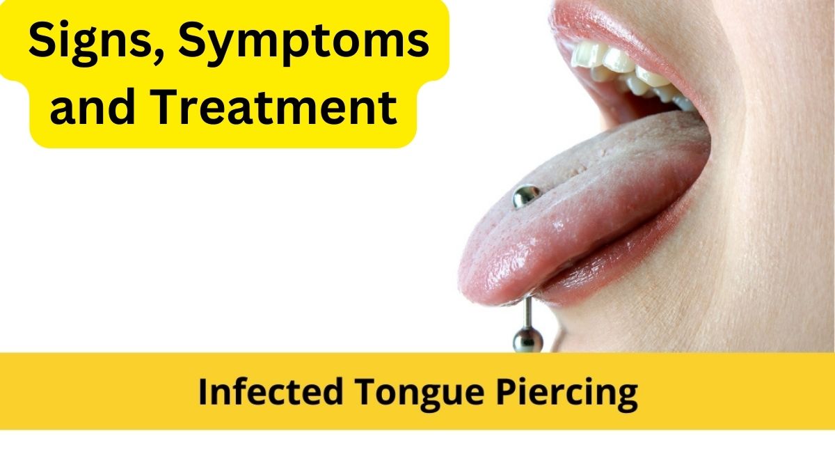 Is Your Tongue Piercing Infected Signs Symptoms And Treatment