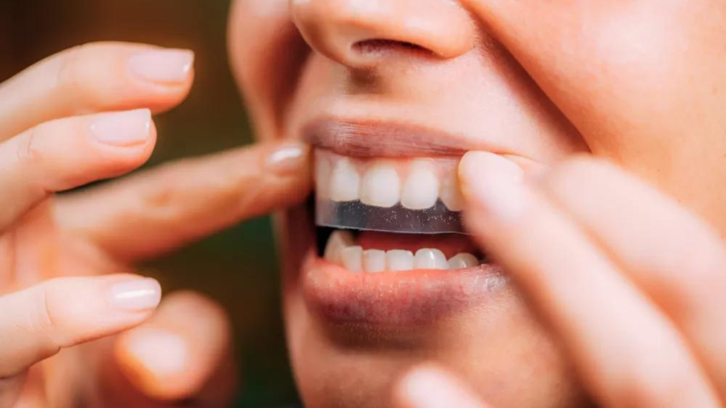 Teeth Whitening Strips